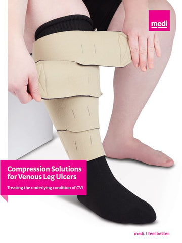 VENOUS LEG ULCER 4-PAGE BROCHURE